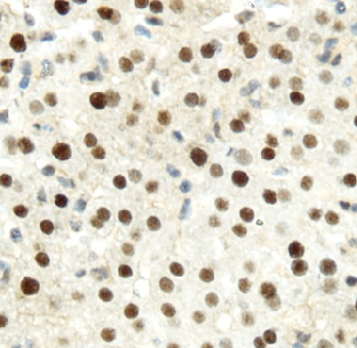 HNF4A antibody|HNF4A抗体