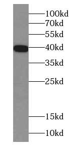 RPSA antibody|RPSA抗体 FNab04689