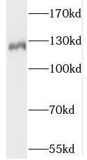 Slc4a8 antibody|Slc4a8抗体
