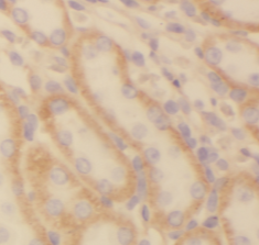 NDUFS5 antibody|NDUFS5抗体 FNab0