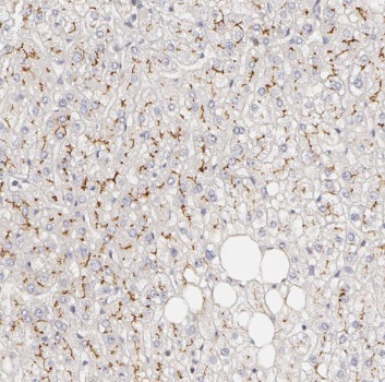 PTCH1 antibody|PTCH1抗体 FNab069