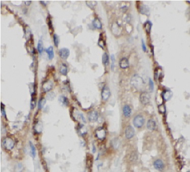 AP2M1 antibody|AP2M1抗体