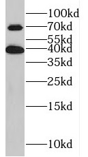 KLHL14 antibody|KLHL14抗体 FNab0