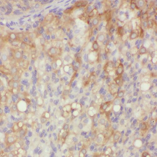 QDPR antibody|QDPR抗体