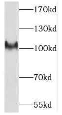 PCDHA3 antibody|PCDHA3抗体