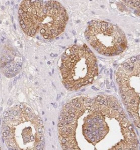 STK4 antibody|STK4抗体