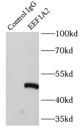 DDX50 antibody|DDX50抗体