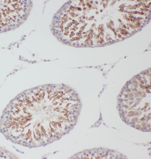 OXCT2 antibody|OXCT2抗体