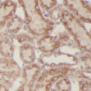 USP33 antibody|USP33抗体 FNab093