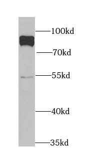 PARN antibody|PARN抗体