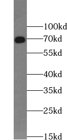 UTP6 antibody|UTP6抗体