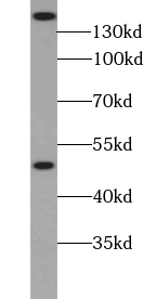 ZRANB3 antibody|ZRANB3抗体