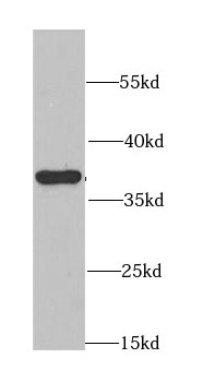 CDK6 antibody|CDK6抗体 FNab01562