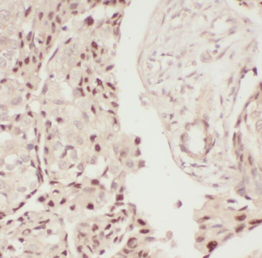 PCK2 antibody|PCK2抗体