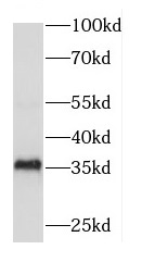 DBP antibody|DBP抗体