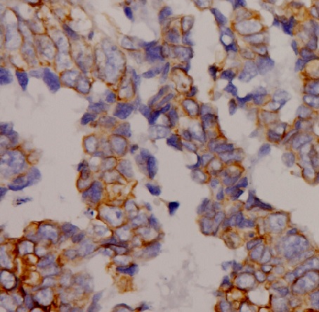 AQP9 antibody|AQP9抗体