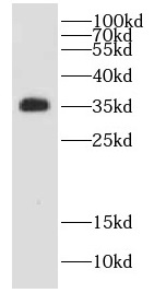 COQ9 antibody|COQ9抗体