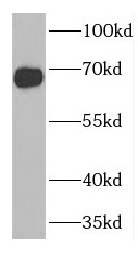 FANCG antibody|FANCG抗体
