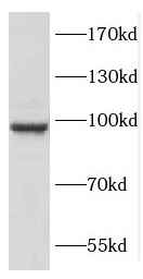 COPG2 antibody|COPG2抗体