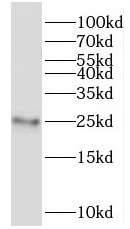 MRPL24 antibody|MRPL24抗体