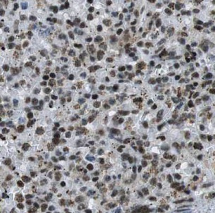 GATA1 antibody|GATA1抗体 FNab033