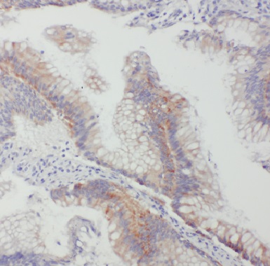 GJB2 antibody|GJB2抗体 FNab01859