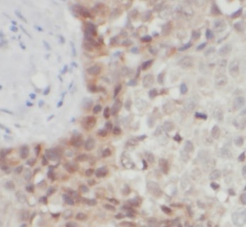 AKT1 antibody|AKT1抗体 FNab00271