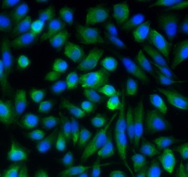 MTOR antibody|MTOR抗体 FNab11071