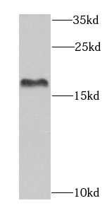 EIF1AX antibody|EIF1AX抗体 FNab0