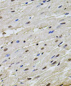 SET antibody|SET抗体