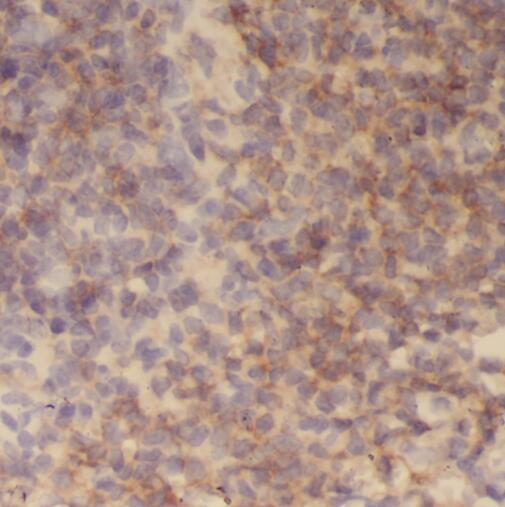 TMCO6 antibody|TMCO6抗体