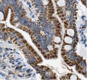VIL1 antibody|VIL1抗体 FNab09406