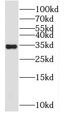 SRM antibody|SRM抗体
