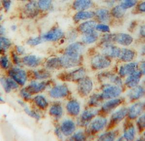 PDHB antibody|PDHB抗体