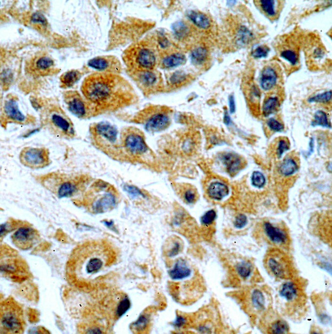 KRT10 antibody|KRT10抗体