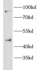 CRACR2A antibody|CRACR2A抗体