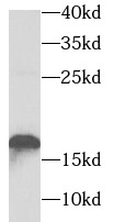 TNNC2 antibody|TNNC2抗体