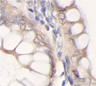 DTL antibody|DTL抗体 FNab10365