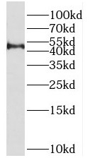 PRMT8 antibody|PRMT8抗体
