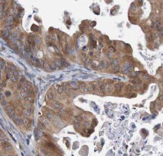 CFL1 antibody|CFL1抗体 FNab01826