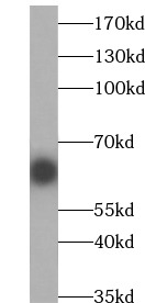RECQL5 antibody|RECQL5抗体