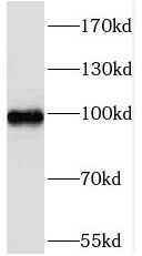 SIX4 antibody|SIX4抗体
