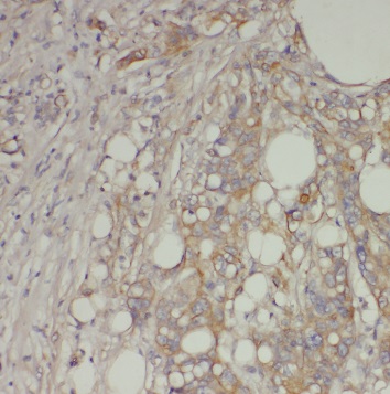 SOCS6 antibody|SOCS6抗体