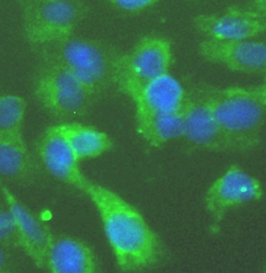RIGI antibody|RIGI抗体 FNab02318