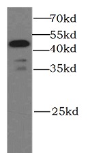 CASP9 antibody|CASP9抗体 FNab012