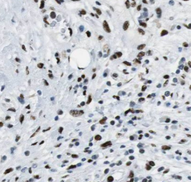 CPA6 antibody|CPA6抗体