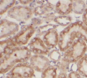 Collagen Type IV antibody|Coll