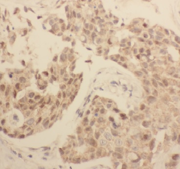 AGFG1 antibody|AGFG1抗体