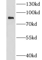 CHPF antibody|CHPF抗体