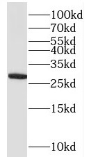 QDPR antibody|QDPR抗体